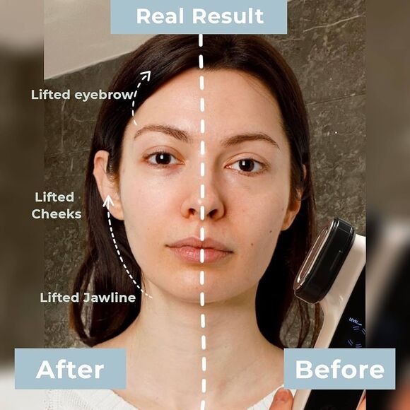 Aephro 6-in-1 Multifunction Skin Tightening Machine NEW - Picture 3 of 11